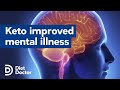 Keto diet improved mental illness