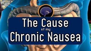 The Cause of my Mysterious Chronic Nausea | ALifeLearned