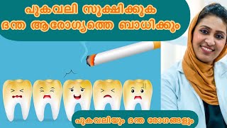 പുകവലി സൂക്ഷിക്കുക ദന്ത ആരോഗ്യത്തെ ബാധിക്കും| പുകവലിയും ദന്ത രോഗങ്ങളും|effects of smoking on teeth