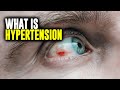 What is Hypertension