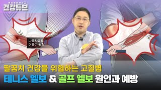 [KNN건강튜브] 일상을 괴롭히는 통증, 테니스 엘보 \u0026 골프 엘보