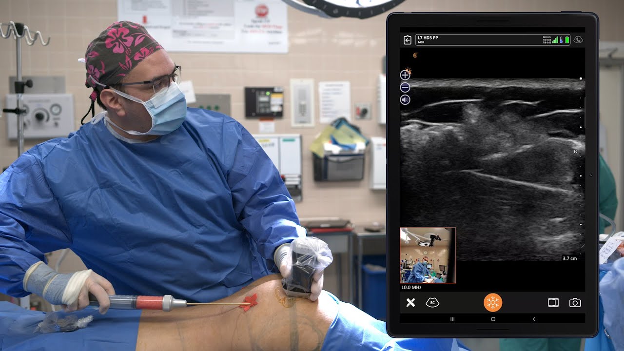 Ultrasound Guided BBL Procedure - YouTube