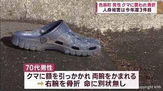 宮城県色麻町　クマに襲われて男性けが　右腕を骨折