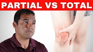 Difference Between a Partial Knee Replacement and Total Knee Replacement