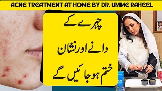 Acne Treatment At Home By Dr. Umme Raheel | Chehre K Danay Gayab | DR.Umme Raheel