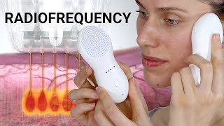 Radiofrequency Skin 'Tightening' Treatments - Do They Really Work \u0026 If So, How? (Nebulyft Science)