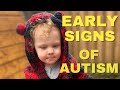 AUTISM EARLY SIGNS 2 YEAR OLD (includes footage)