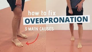 Pronated Feet and How to Fix 3 Different Causes of OVERPRONATION