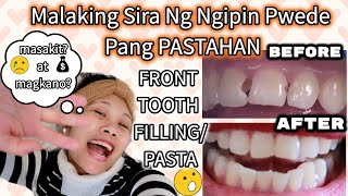 HOW MUCH DOES A FILLING/PASTA COST? | MALAKING SIRA NG NGIPIN PWEDE PANG PASTAHAN | MAGKANO NGA BA?