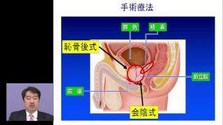 前立腺がんの治療方針　赤倉 功一郎