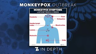 ECDOH: monkeypox detected in Erie County, risk to general public currently low