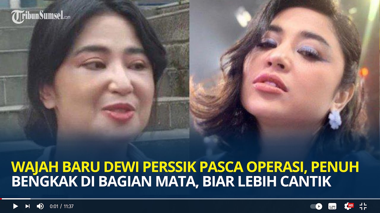 Wajah Baru Dewi Perssik Pasca Operasi, Penuh Bengkak Di Bagian Mata ...