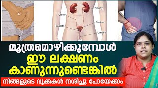 മൂത്രമൊഴിക്കുമ്പോൾ ഈ ലക്ഷണങ്ങൾ കാണുന്നുണ്ടോ | എങ്കിൽ കിഡ്‌നി തകരാറിലാകും