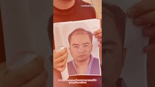 เห็นรีวิวคุณหมอพิ้งกี้ตัดสินใจทำเลย  #ปลูกผม  #3mhairtransplant #masterpiecehospital #hairtransplant