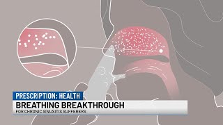 Breathing Breakthrough for Chronic Sinusitis Sufferers