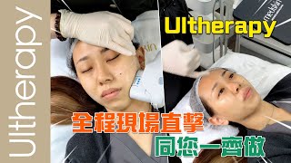 Ultherapy HIFU｜提拉緊緻最有效？｜改善虎紋、雙下巴、蘋果肌、眼周冇難度｜全程陪您一齊做！｜員工講解療程感想｜medskinHK