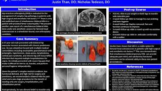 Simultaneous Bilateral Hip Resection Arthroplasty: A Case Study