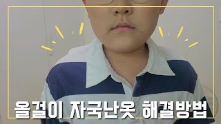 옷걸이 자국난 옷 해결 방법!!