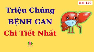 Triệu Chứng BỆNH GAN Theo “Đa Góc Nhìn”, Không Làm Sạch Được Lá Gan Vì 5 Lý Do Này
