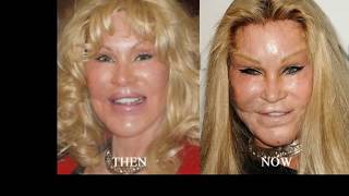Jocelyn Wildenstein :Plastic Surgery Fail Women You Won’t Believe Are Real
