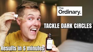 THE ORDINARY CAFFEINE SOLUTION 5% | How to use and 30 day trial. Its a miracle for dark circles