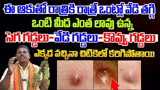 ఒంటి మీద సెగ గడ్డలు వేడి గడ్డలు ఎక్కడ వచ్చినా చిటికెలో తగ్గిస్తుంది ||  Gaddalu | Sri Vahini Media