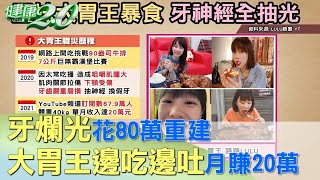 正妹大胃王邊吃邊吐月賺20萬 牙爛光花80萬重建 健康2.0