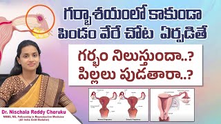 పిండం ట్యూబులో ఏర్పడితే తల్లికి ప్రమాదమా...? || What Is Ectopic Pregnancy || Ekam Fertility \u0026 Women