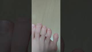 새끼발가락 떨림 twitching toe