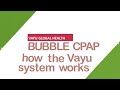 Vayu Bubble CPAP: how the Vayu system works