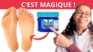 Mets du VICKS VapoRub sous tes pieds et regarde ce qu'il se passe !