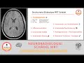 Basics Neuroradiologie - MRT Kopf: Systematische Bildanalyse