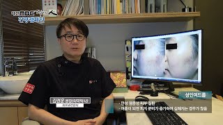 [대전MBC 닥터인] 피부과 - 성인 여드름