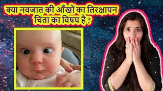 शिशु की तिरछी आँख का घरेलु उपचार l cross eyes in newborns l lazy eyes