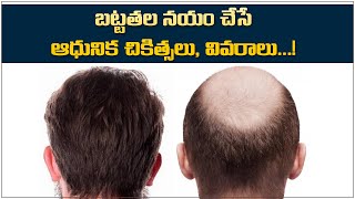 బట్టతల నయం చేసే ఆధునిక చికిత్సలు, వివరాలు || Hair Growth on Bald Head Naturally in Telugu