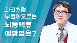 [Dr.log] 꽈리처럼 부풀어오르는 뇌혈관 '뇌동맥류'의 치료와 예방