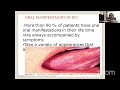 oral manifestations in hiv