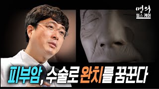 명의 헬스케어 - 피부암, 수술로 완치를 꿈꾼다