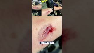 Anti-ICE rioter CHARGED for allegedly ATTACKING FEDERAL AGENT #foxnews #news #us #fox