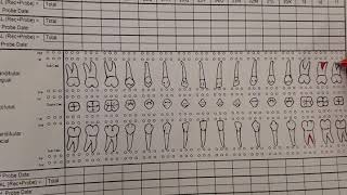 Charting Furcations, Mobility, CAL
