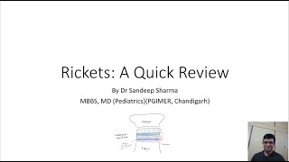 Rickets: A Quick Review by Dr Sandeep Sharma