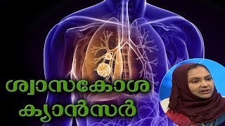 Dr Q :ശ്വാസകോശ ക്യാന്‍സര്‍ | Lung Cancer | 5th February 2019