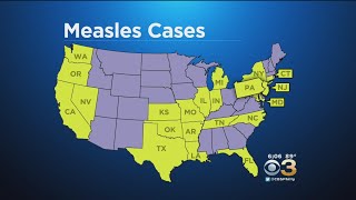 CDC Monitoring Measles Outbreak In Over 20 States, Including New Jersey, Pennsylvania