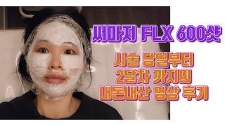 연예인이하는 관리ㅣ써마지FLX600샷 후기ㅣ시술 당일부터 60일까지의 변화ㅣ브이로그