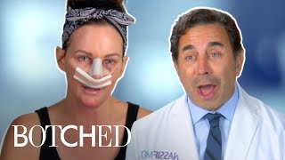Will Lupus Stop Lisa From Getting A 3rd Nose Job?! FULL TRANSFORMATION | Botched