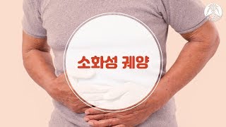 [소화기: 소화성 궤양]