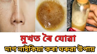 মুখত থকা দাগ নাইকিয়া কৰাৰ এটা ঘৰুৱা উপায়।। Remove dark spot naturally in Assamese ।।