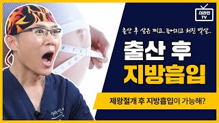 [더라인성형외과][조재호박사]제왕절개 하고 운동을 해도 아랫배가 안빠지는데, 지방흡입 가능한가요?