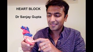 Heart block