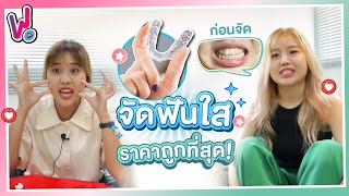 รีวิวพลีชีพ I จัดฟันใส ในงบ 37,000 เข้าคลินิกครั้งเดียว ไม่ต้องถอนฟัน !!